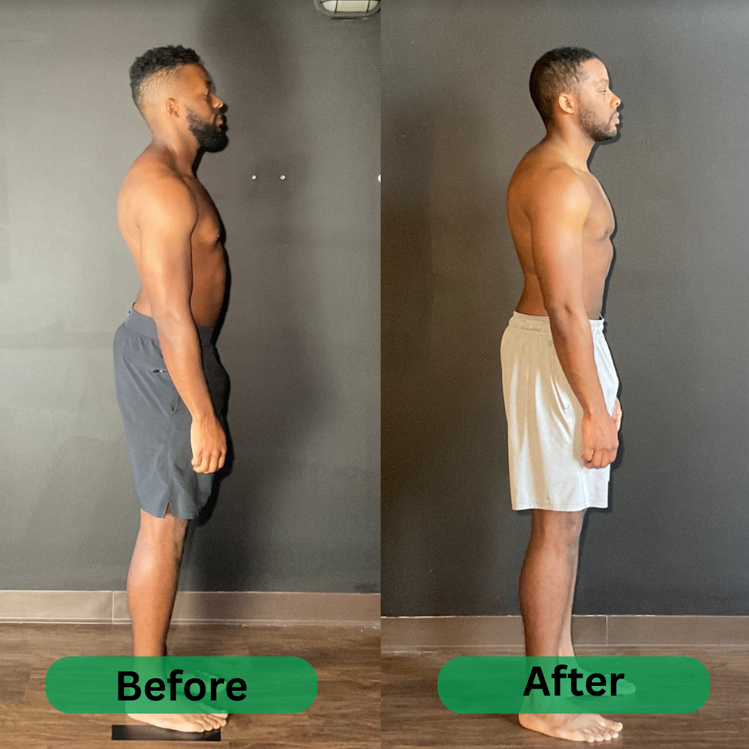 SpineAlign Pro