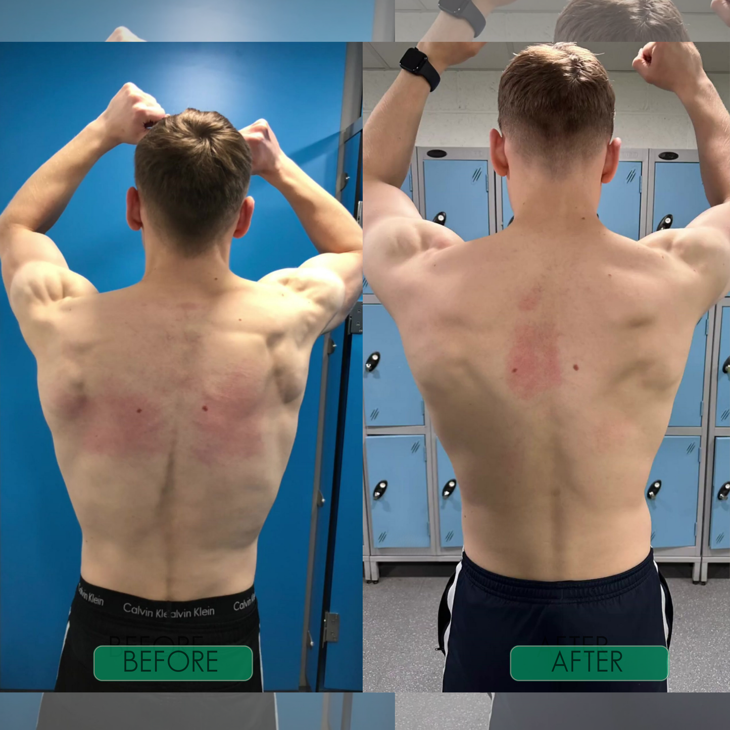 SpineAlign Pro