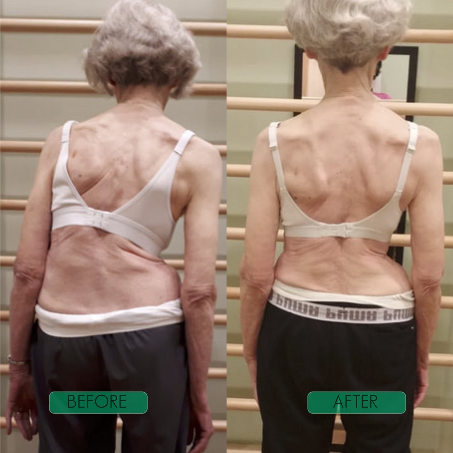 SpineAlign Pro
