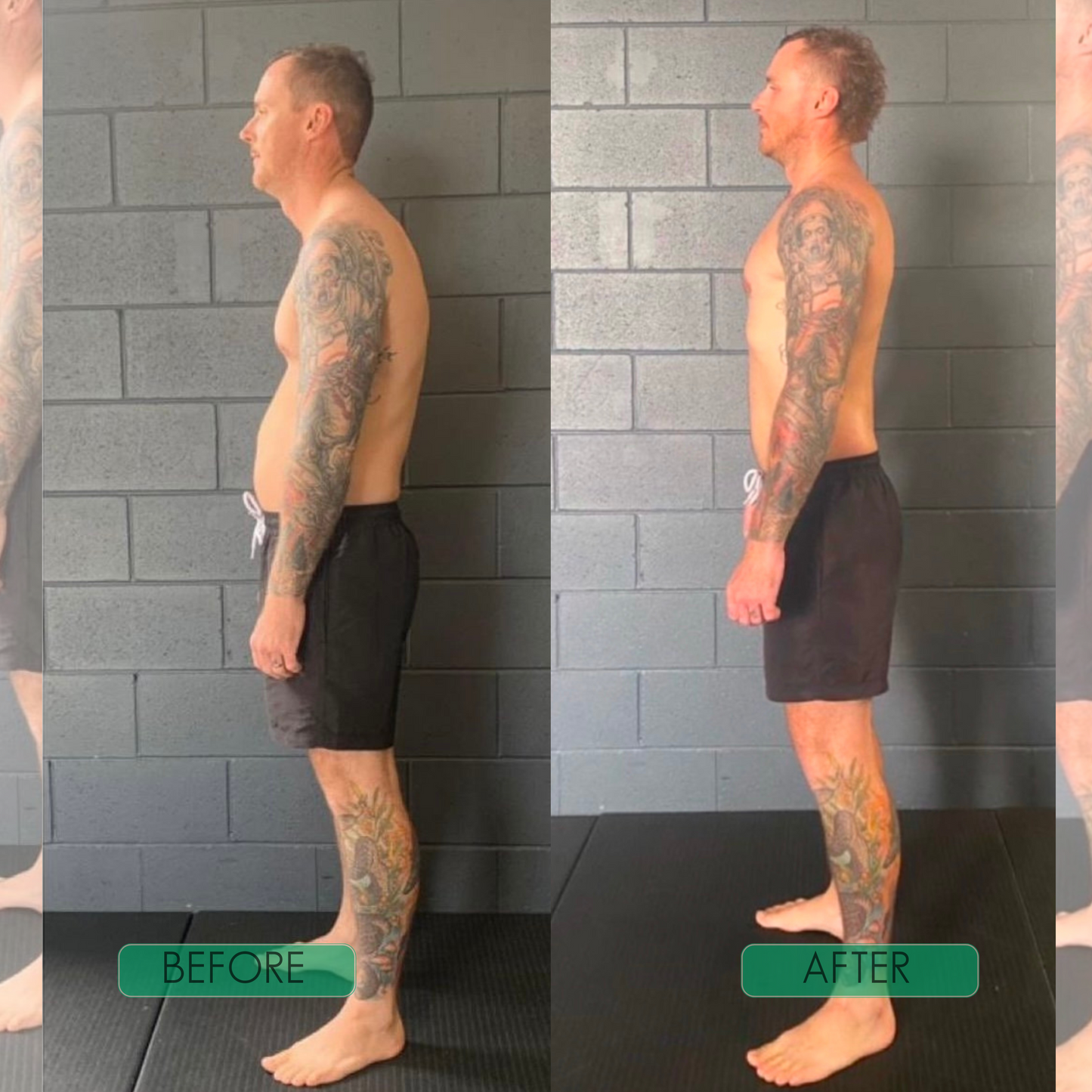 SpineAlign Pro