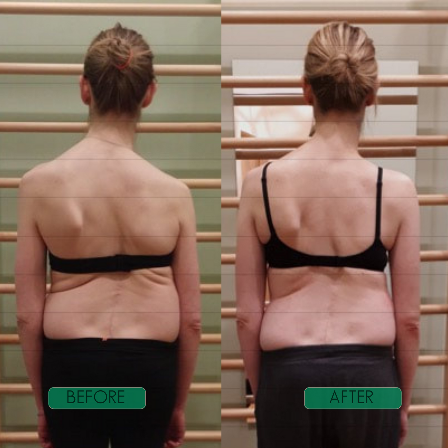 SpineAlign Pro
