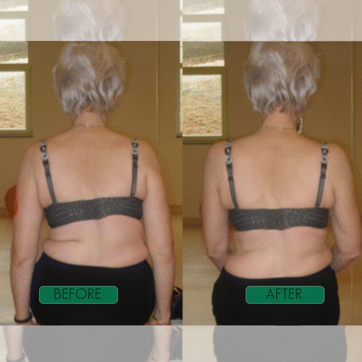 SpineAlign Pro
